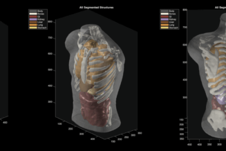 Midjourney goes from generating cat images to full-body ultrasound scans