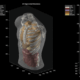Midjourney goes from generating cat images to full-body ultrasound scans