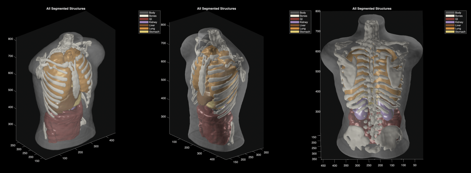 ultrasound_phantom_segmentation-b254a71d083eb5c9