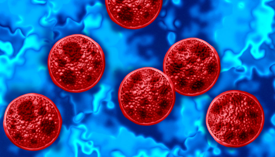 Trump Administration's CDC Cuts Under Fire After Cyclospora Outbreak